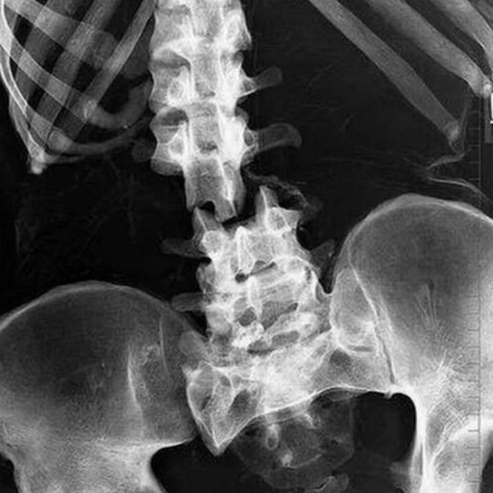 рентген 2.jpg